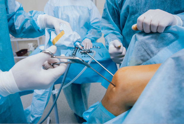artroskopia kolana centrum medyczne medicum